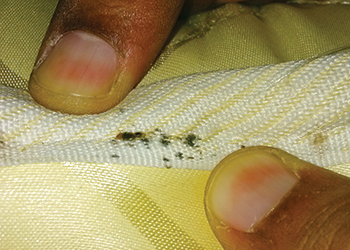 Blood spots on mattresses ... a clear sign of bed bugs.